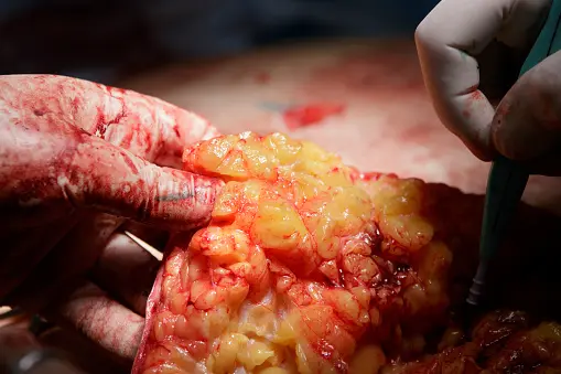 FSC-certified wood samples showing natural grain